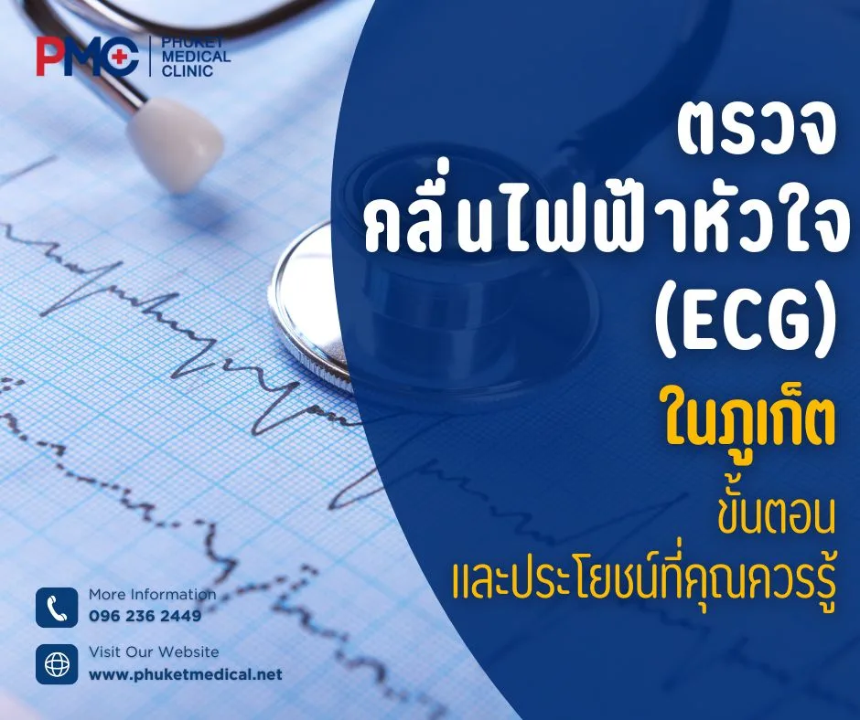 ตรวจคลื่นไฟฟ้าหัวใจ (ECG) ในภูเก็ต ขั้นตอนและประโยชน์ที่คุณควรรู้