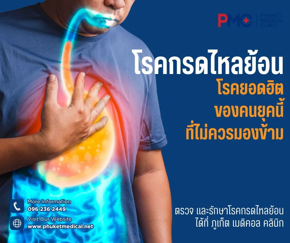 โรคกรดไหลย้อน โรคยอดฮิตของคนยุคนี้ที่ไม่ควรมองข้าม