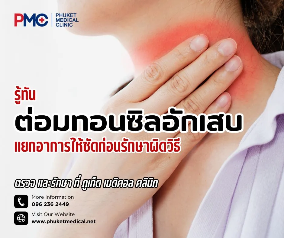 รู้ทันต่อมทอนซิลอักเสบ แยกอาการให้ชัดก่อนรักษาผิดวิธี