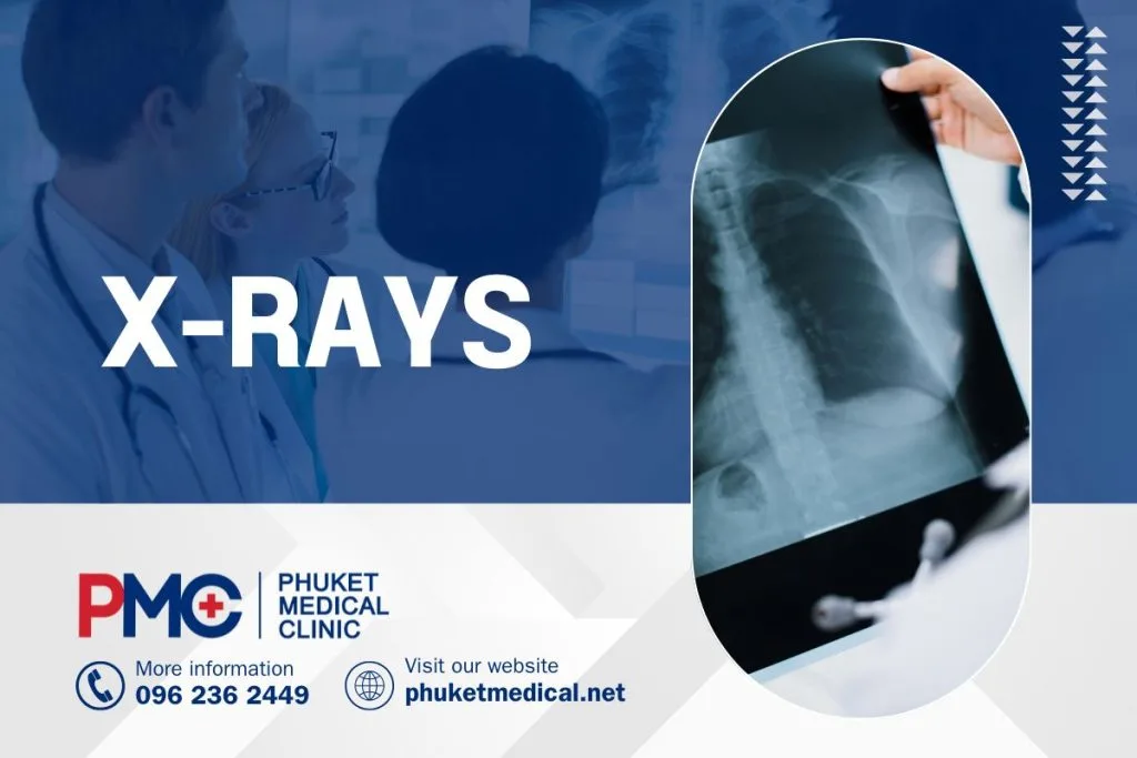 X-rays