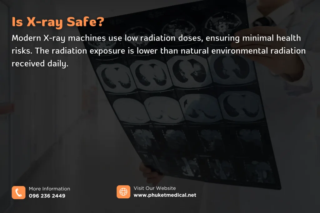 Is X-ray Safe