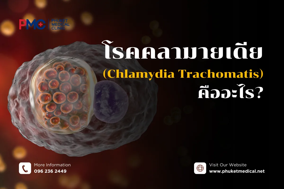 โรคคลามายเดีย (Chlamydia Trachomatis) คืออะไร?