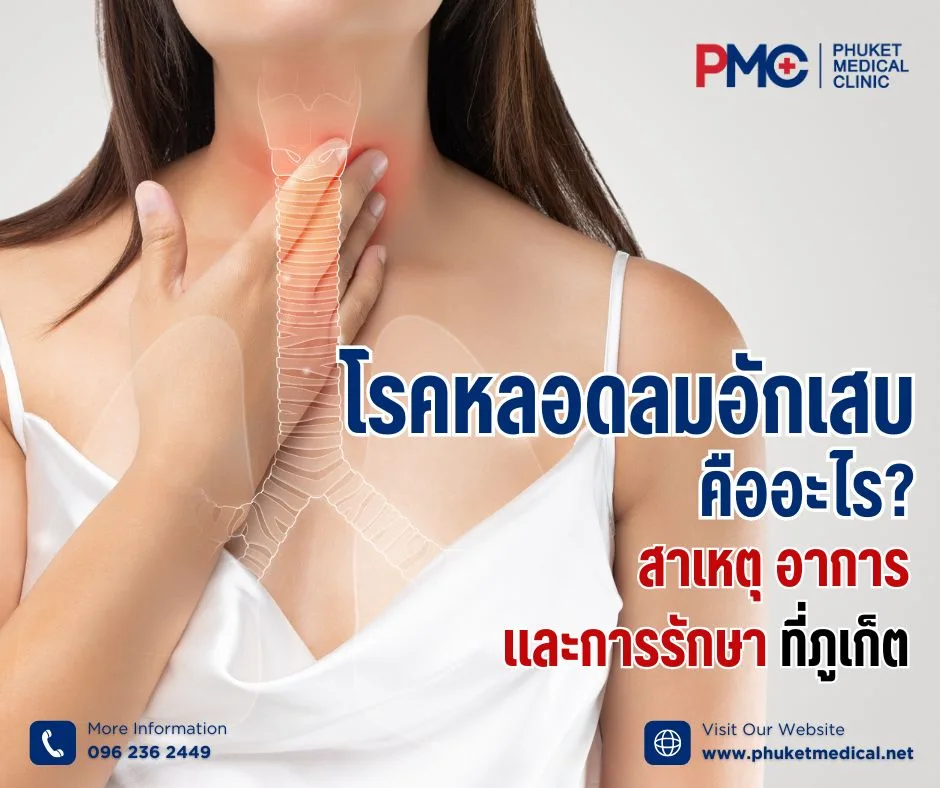 โรคหลอดลมอักเสบ คืออะไร? สาเหตุ อาการ และการรักษา ที่ภูเก็ต