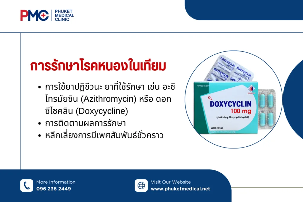 การรักษา โรคหนองในเทียม