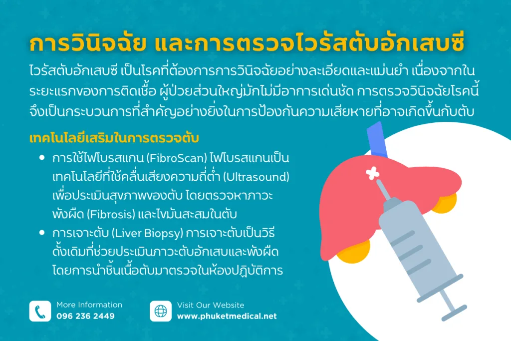 การวินิจฉัย และการตรวจไวรัสตับอักเสบซี