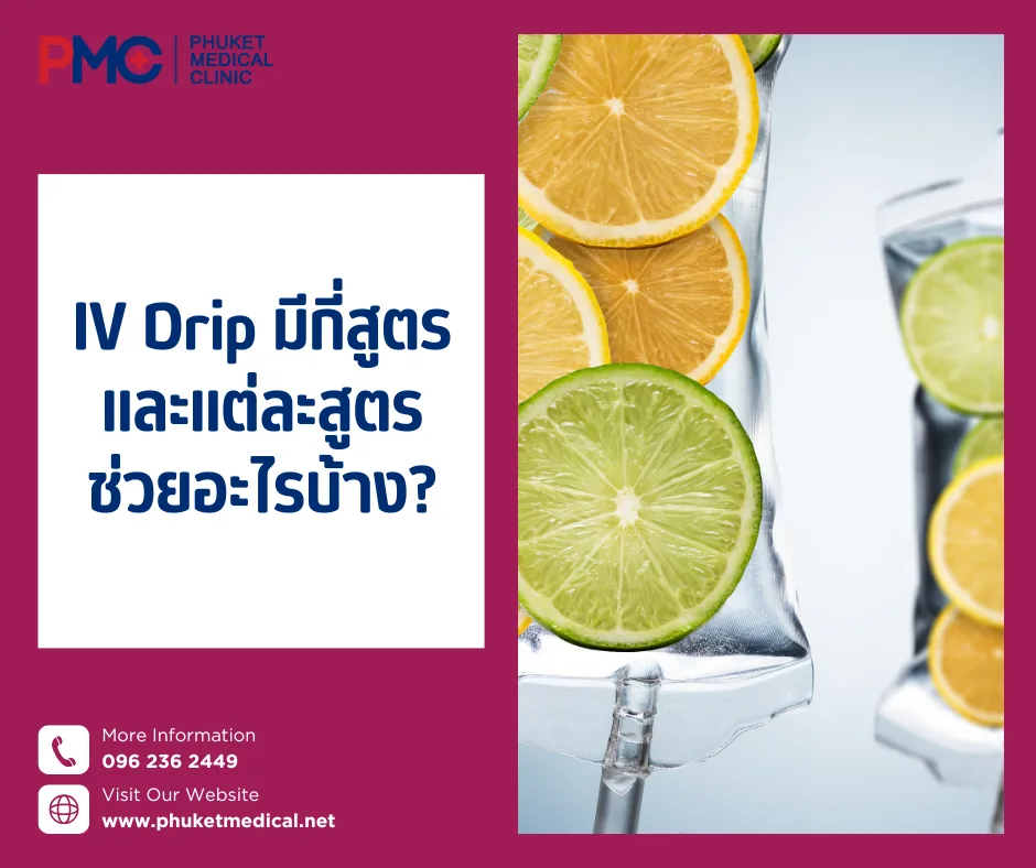 IV Drip มีกี่สูตร และแต่ละสูตร ช่วยอะไรบ้าง