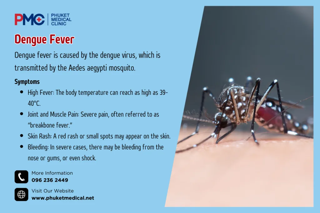 Dengue Fever