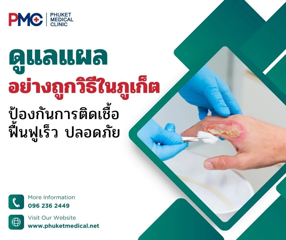 ดูแลแผลอย่างถูกวิธีในภูเก็ต ป้องกันการติดเชื้อ ฟื้นฟูเร็ว ปลอดภัย
