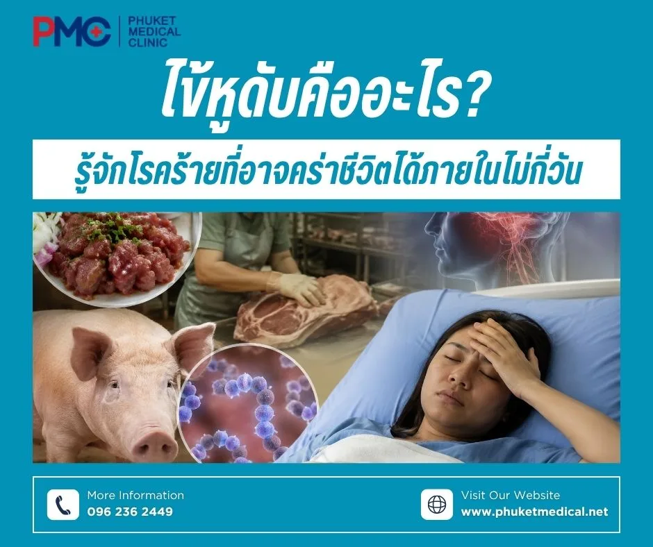 ไข้หูดับคืออะไร? รู้จักโรคร้ายที่อาจคร่าชีวิตได้ภายในไม่กี่วัน