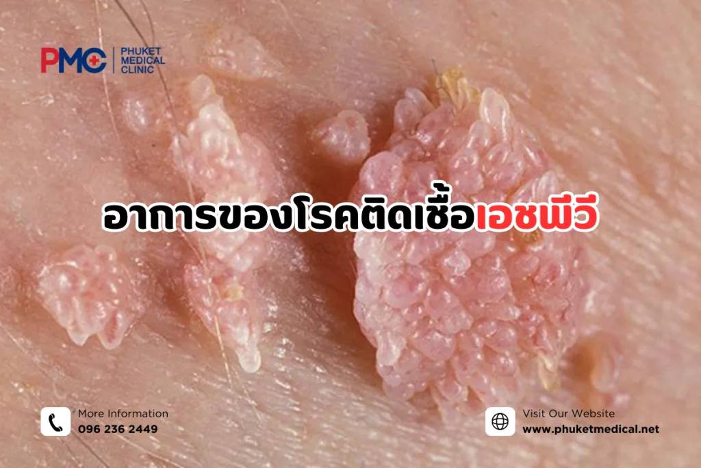 อาการของโรคติดเชื้อเอชพีวี