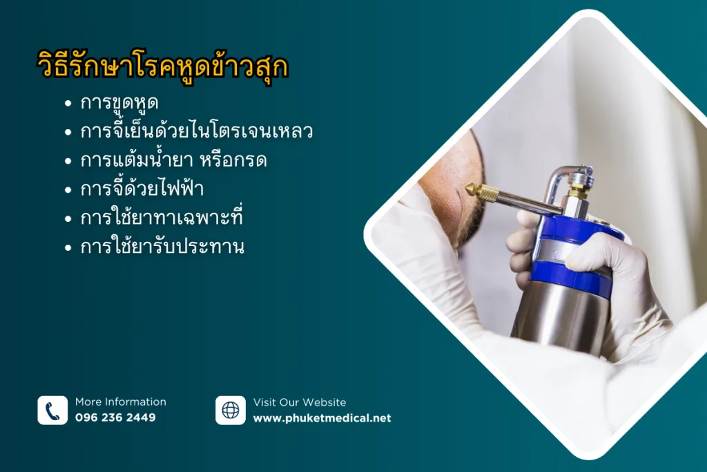 วิธีรักษา โรคหูดข้าวสุก