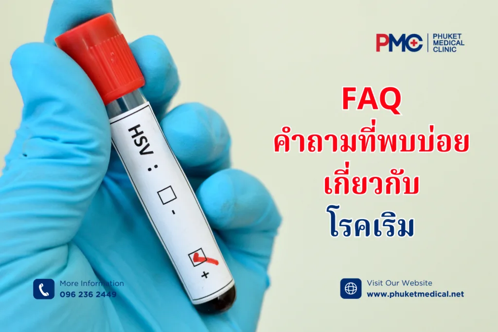 FAQคำถามที่พบบ่อยเกี่ยวกับโรคเริม