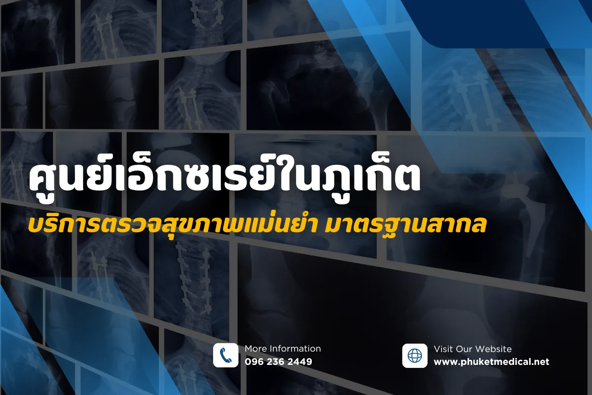ศูนย์เอ็กซเรย์ในภูเก็ต บริการตรวจสุขภาพแม่นยำ มาตรฐานสากล