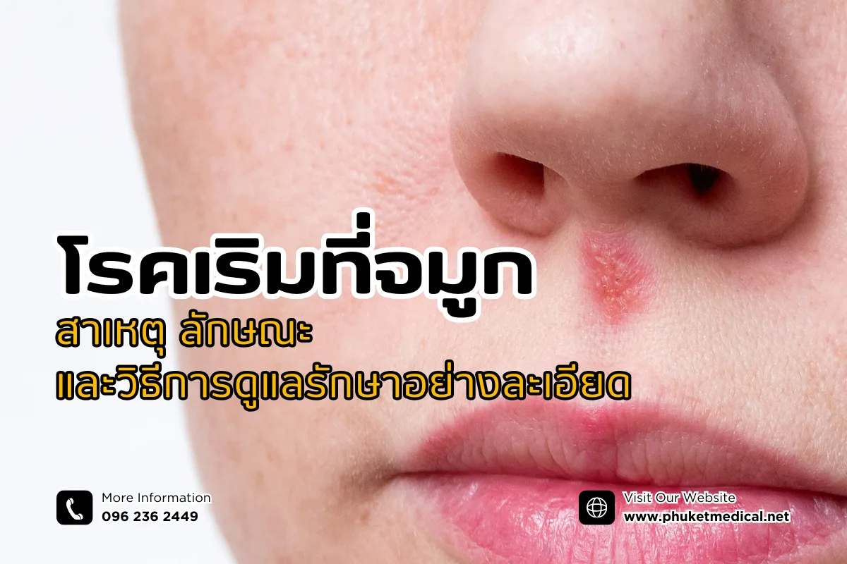 โรคเริมที่จมูก สาเหตุ ลักษณะ และวิธีการดูแลรักษาอย่างละเอียด