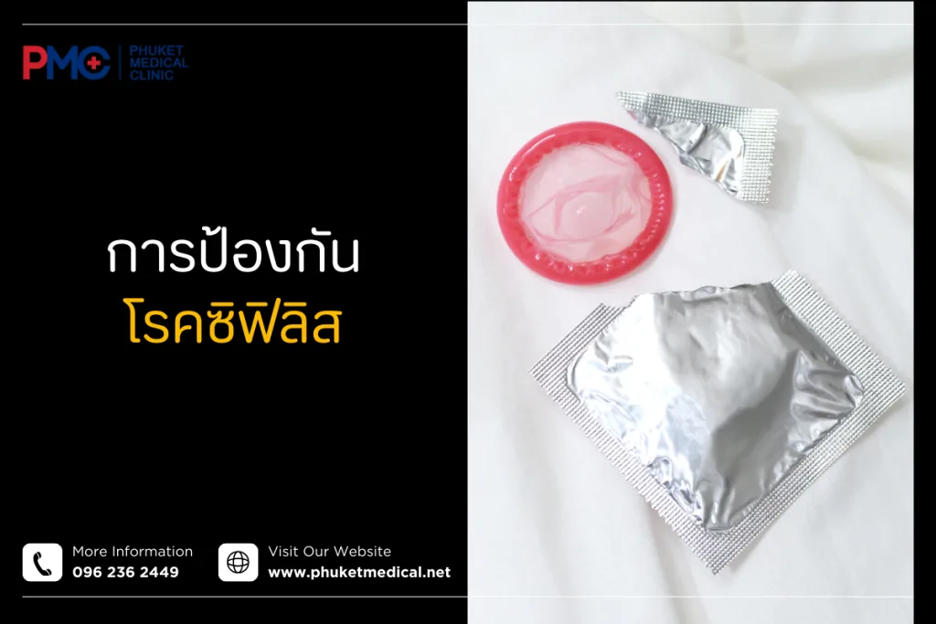 การป้องกันโรคซิฟิลิส