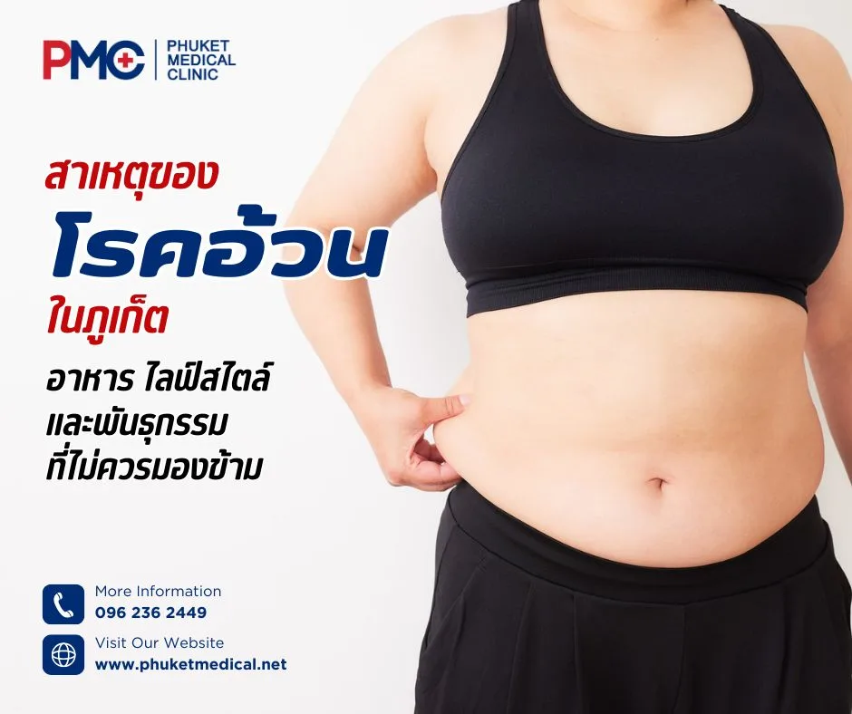 สาเหตุของโรคอ้วนในภูเก็ต อาหาร ไลฟ์สไตล์ และพันธุกรรมที่ไม่ควรมองข้าม