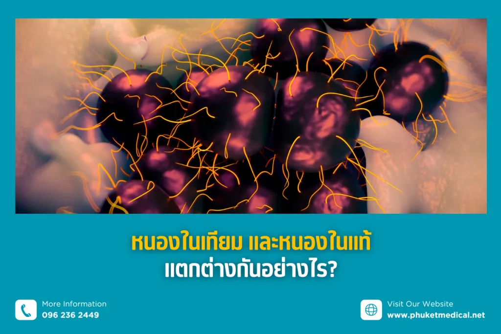 non-gonococcal urethritis