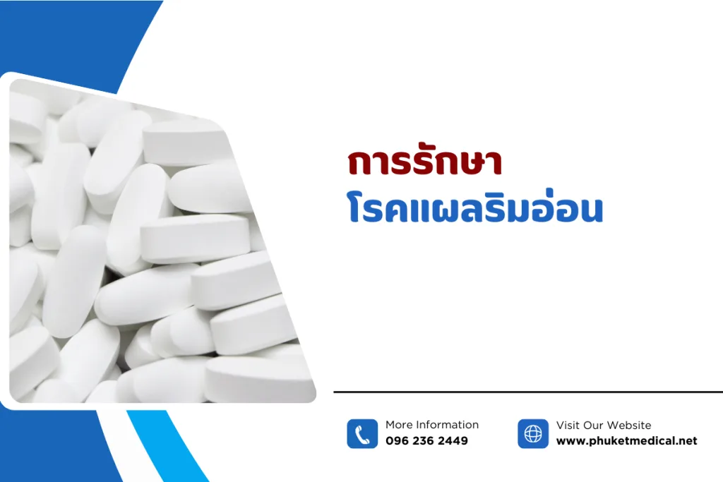 การรักษาโรคแผลริมอ่อน
