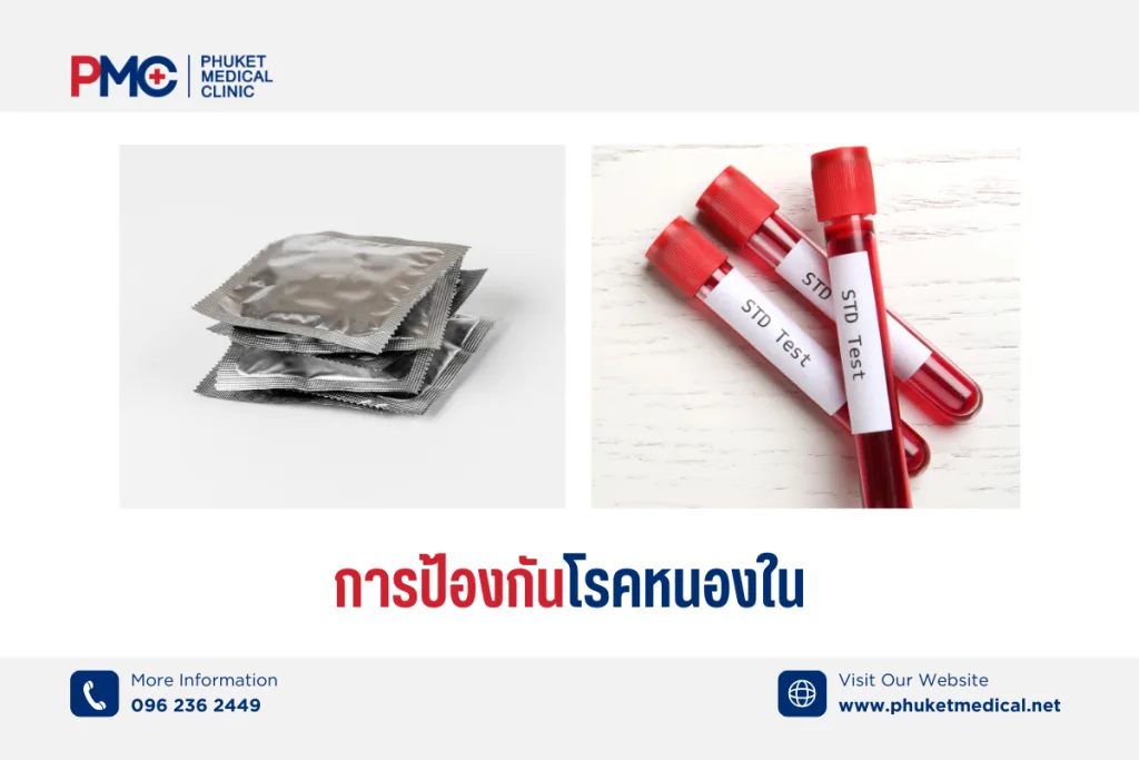 การป้องกันโรคหนองใน