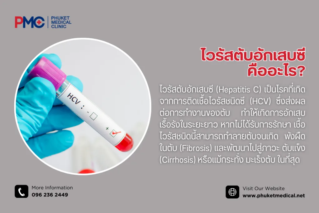ไวรัสตับอักเสบซีคืออะไร?