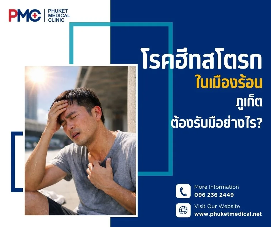 โรคฮีทสโตรกในเมืองร้อน ภูเก็ตต้องรับมืออย่างไร?