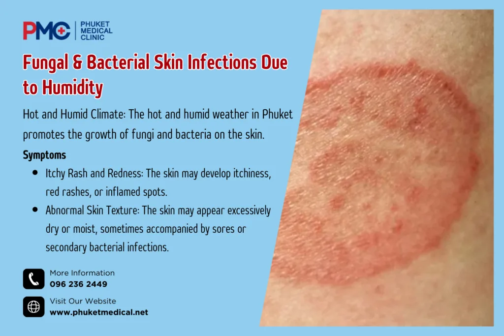 Fungal & Bacterial Skin Infections Due to Humidity