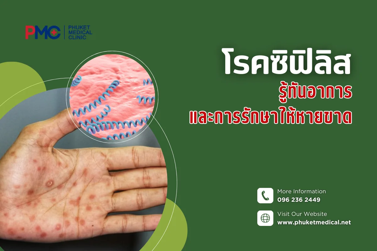 โรคซิฟิลิส รู้ทันอาการและการรักษาให้หายขาด