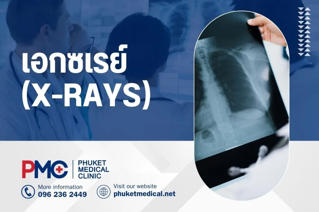 เอกซเรย์ (X-rays)