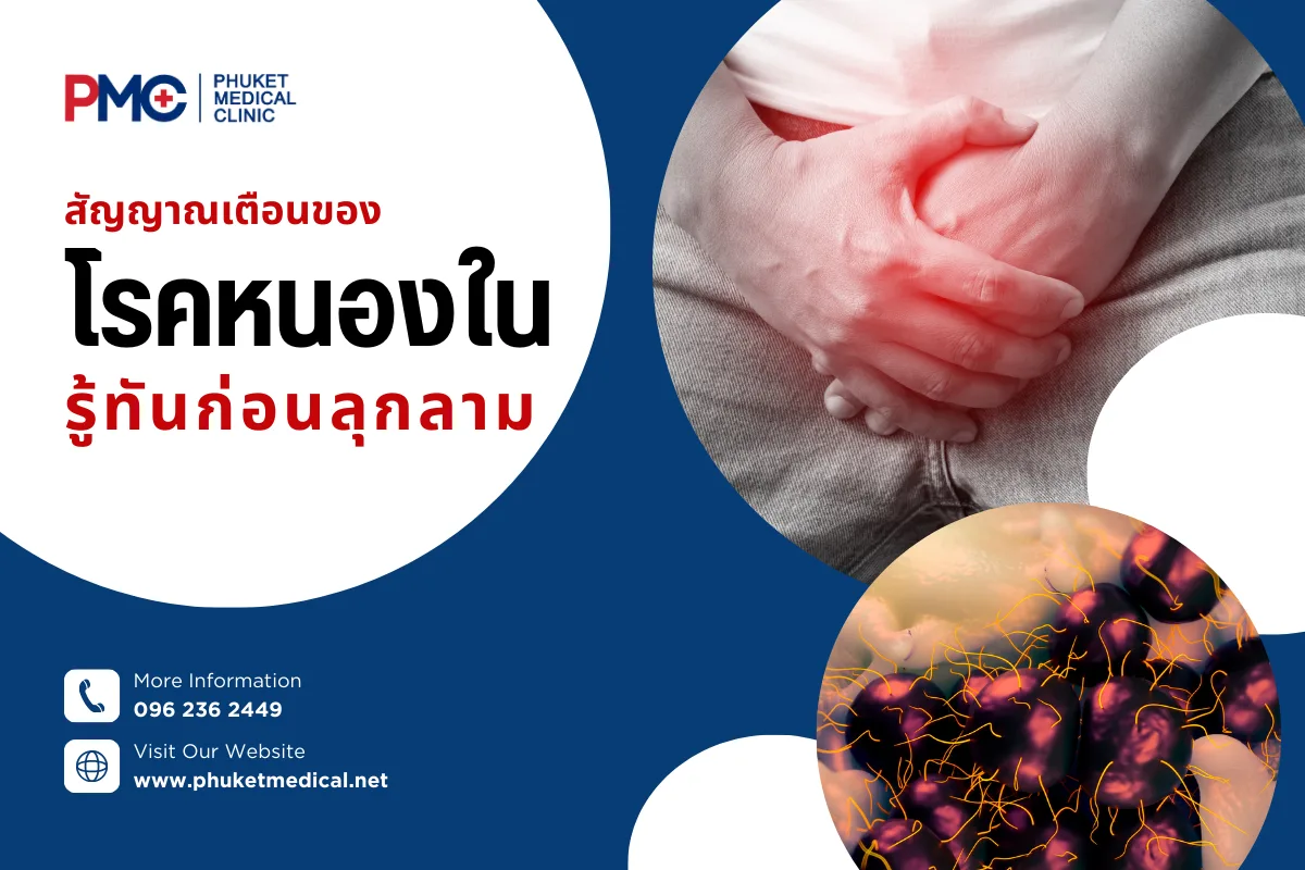 สัญญาณเตือนของโรคหนองในรู้ทันก่อนลุกลาม