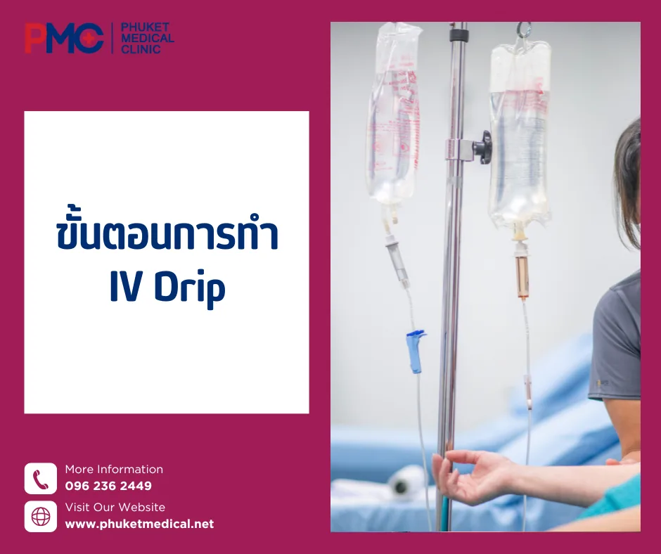 ขั้นตอนการทำ IV Drip