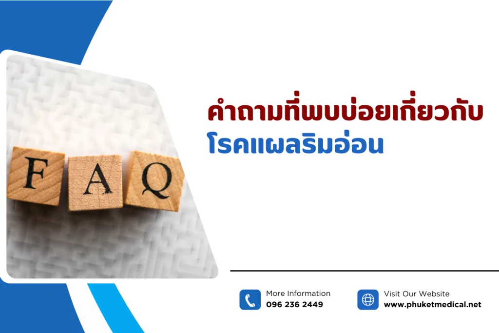 คำถามที่พบบ่อยเกี่ยวกับโรคแผลริมอ่อน
