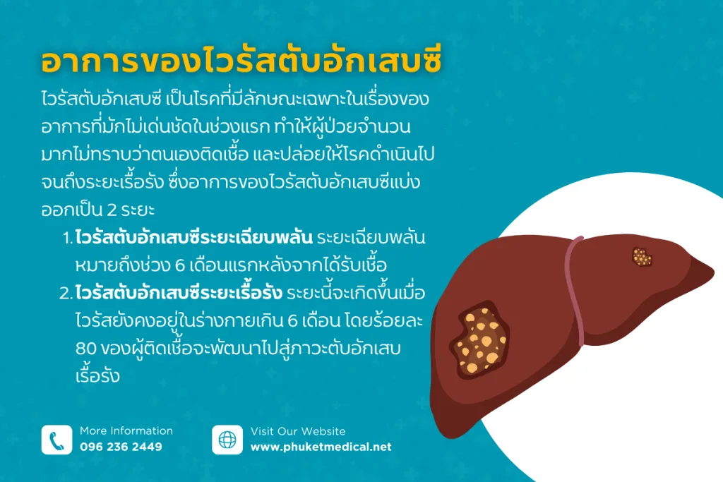 อาการของไวรัสตับอักเสบซี