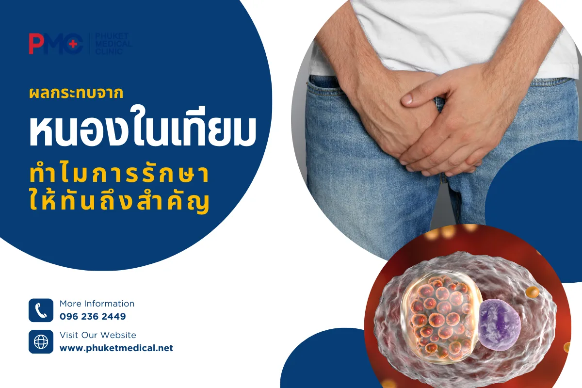 ผลกระทบจากหนองในเทียมทำไมการรักษาให้ทันถึงสำคัญ