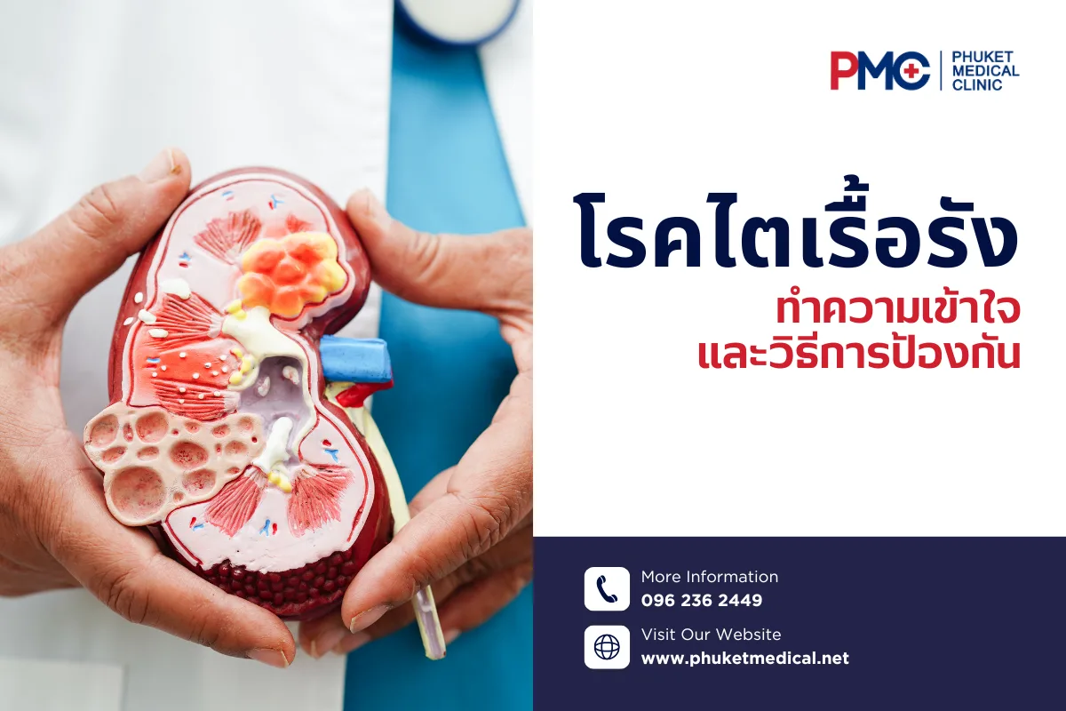 โรคไตเรื้อรังทำความเข้าใจ และวิธีการป้องกัน