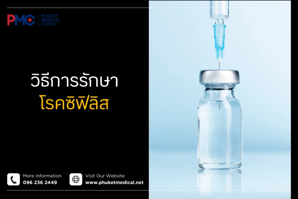 วิธีการรักษาโรคซิฟิลิส