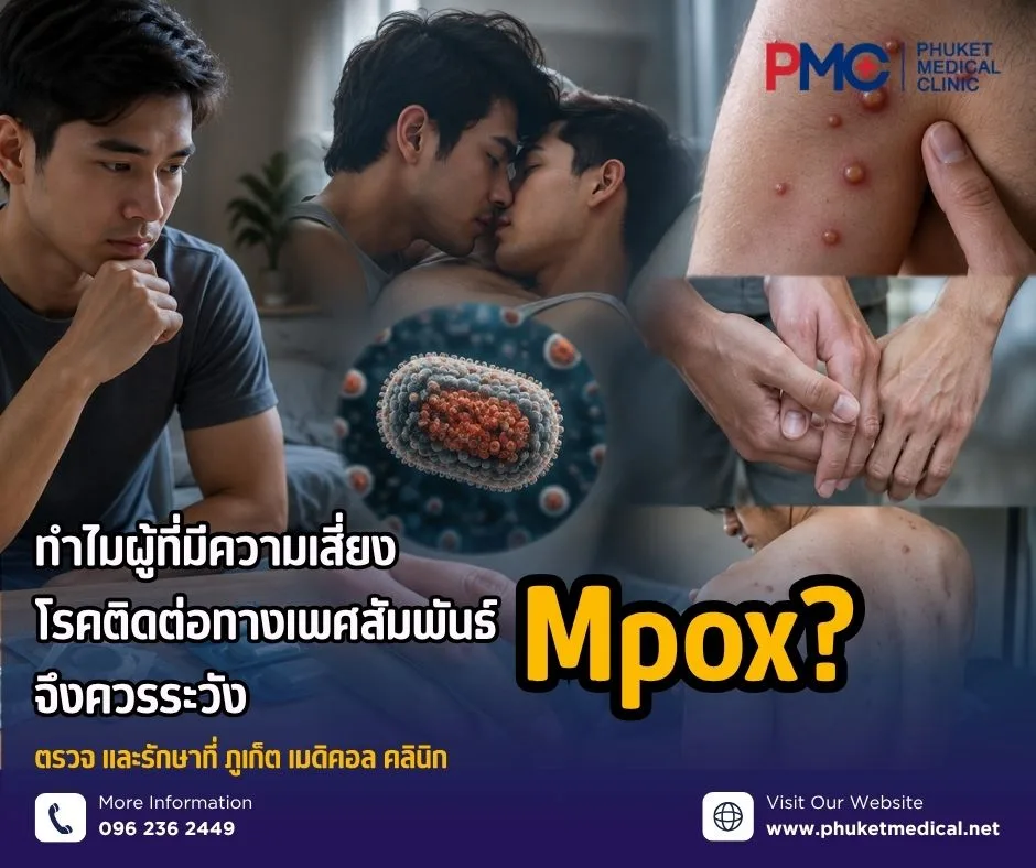 ทำไมผู้ที่มีความเสี่ยงโรคติดต่อทางเพศสัมพันธ์จึงควรระวัง Mpox?