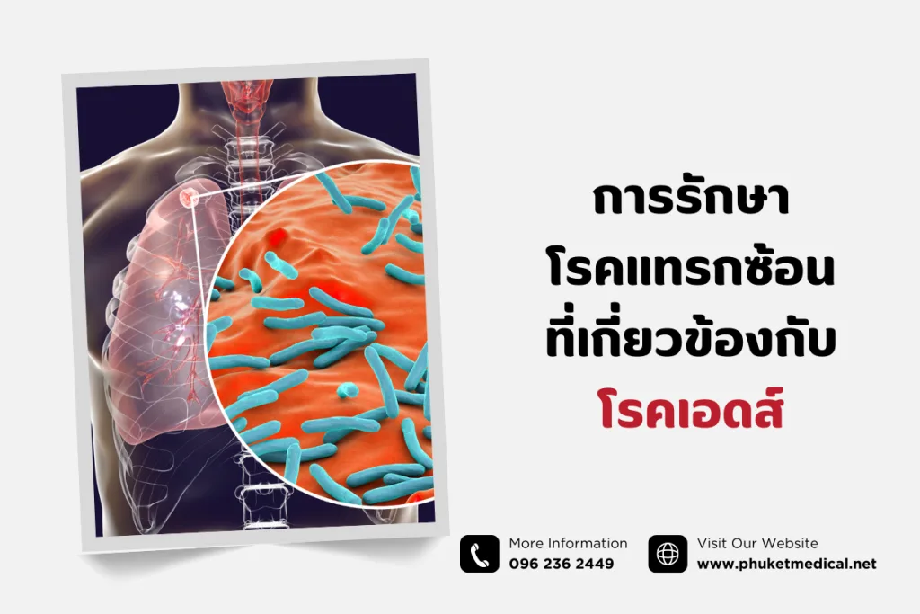 การรักษา โรคแทรกซ้อนที่เกี่ยวข้องกับโรคเอดส์