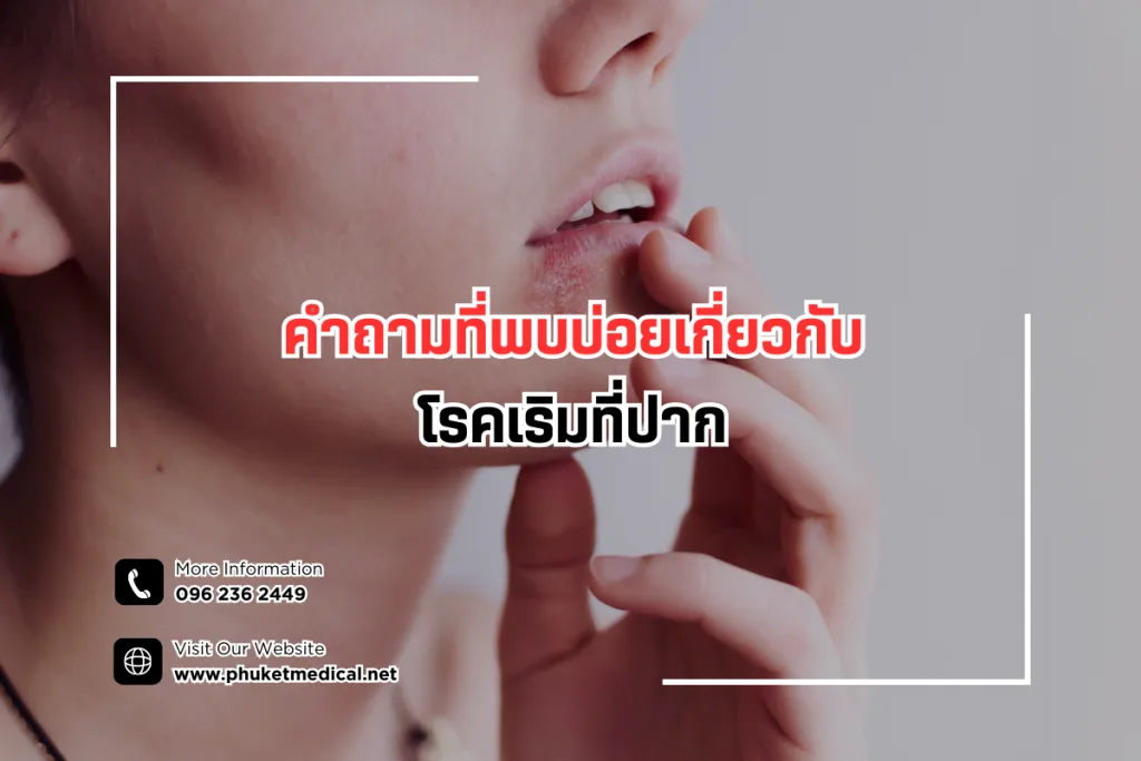 คำถามที่พบบ่อยเกี่ยวกับโรคเริมที่ปาก