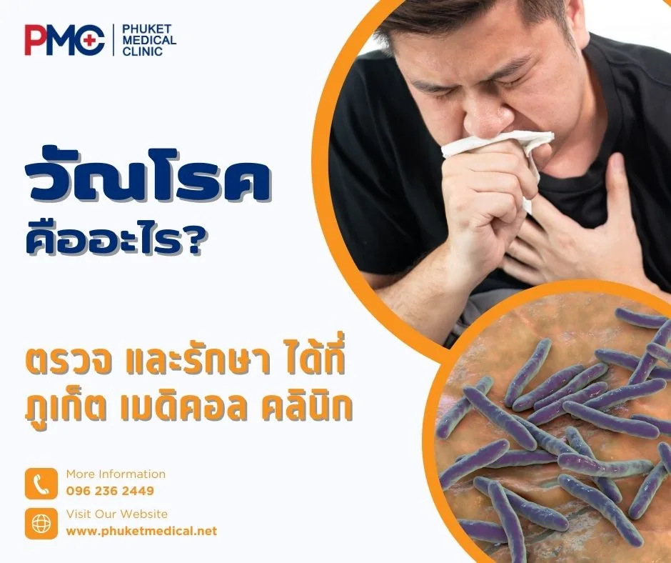 วัณโรคคืออะไร? ตรวจ และรักษาได้ที่ภูเก็ต เมดิคอล คลินิก