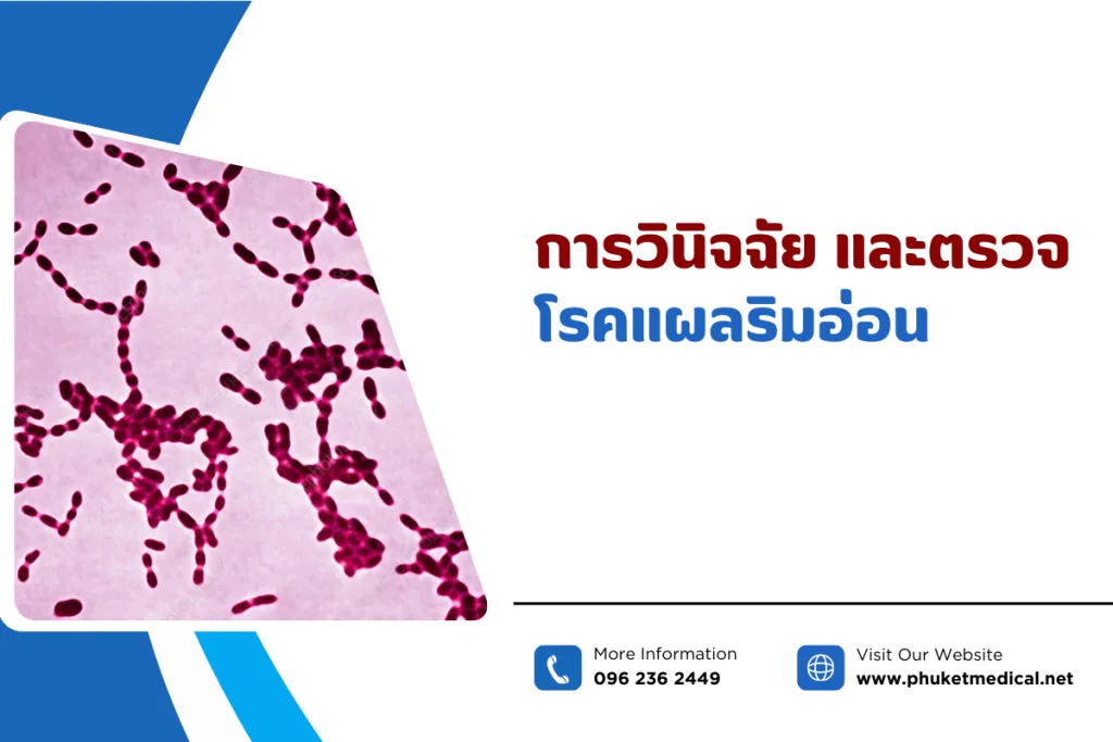 การวินิจฉัย และตรวจโรคแผลริมอ่อน