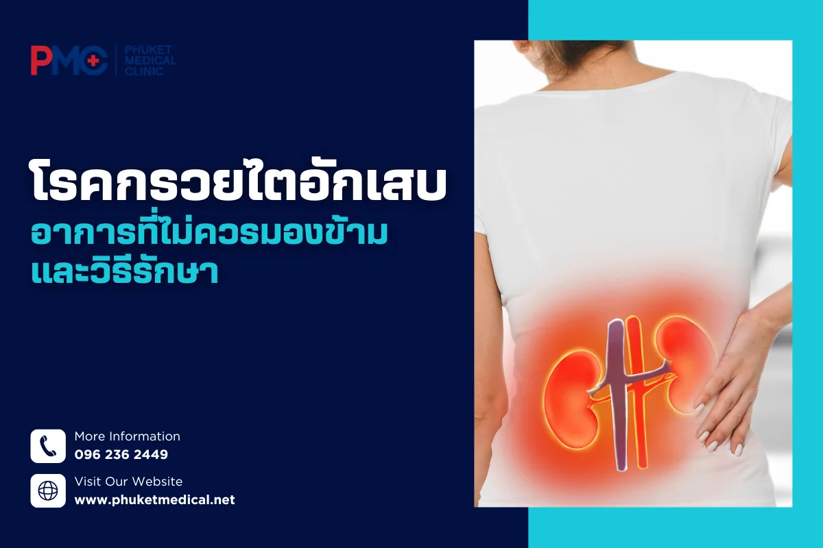 โรคกรวยไตอักเสบอาการที่ไม่ควรมองข้ามและวิธีรักษา