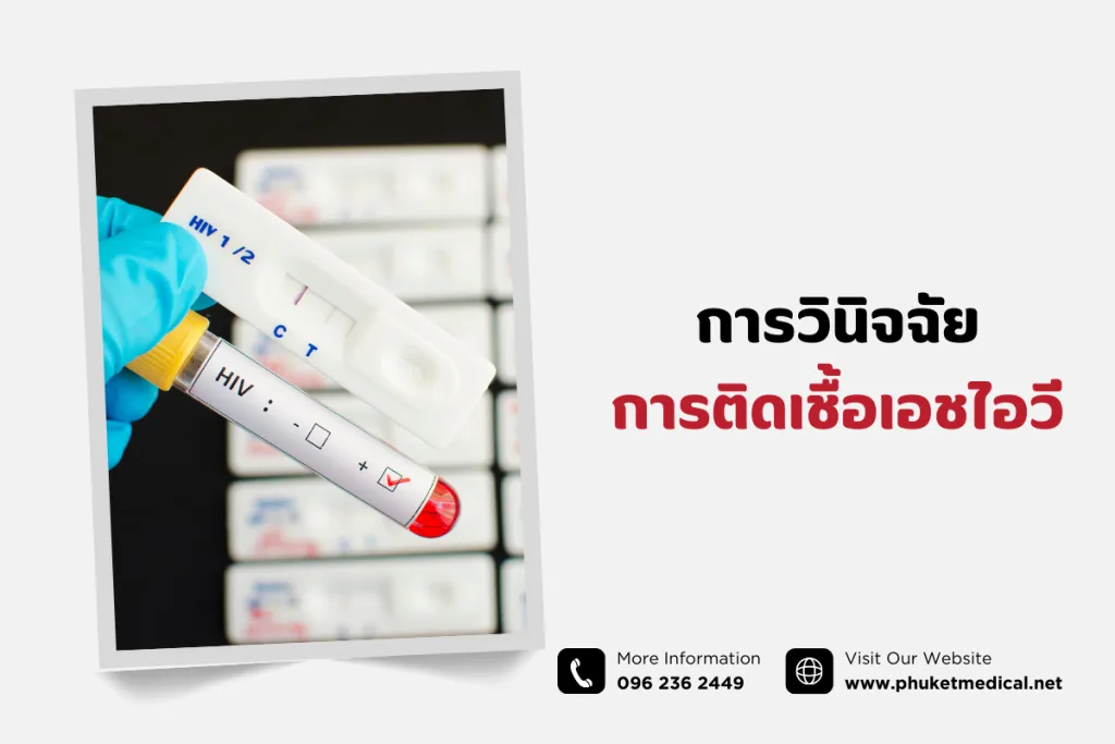 การวินิจฉัย การติดเชื้อเอชไอวี