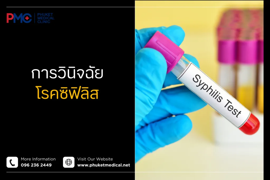 Syphilis infection