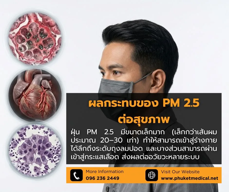 ผลกระทบของ PM 2.5 ต่อสุขภาพ
