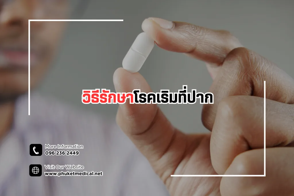 วิธีรักษาโรคเริมที่ปาก
