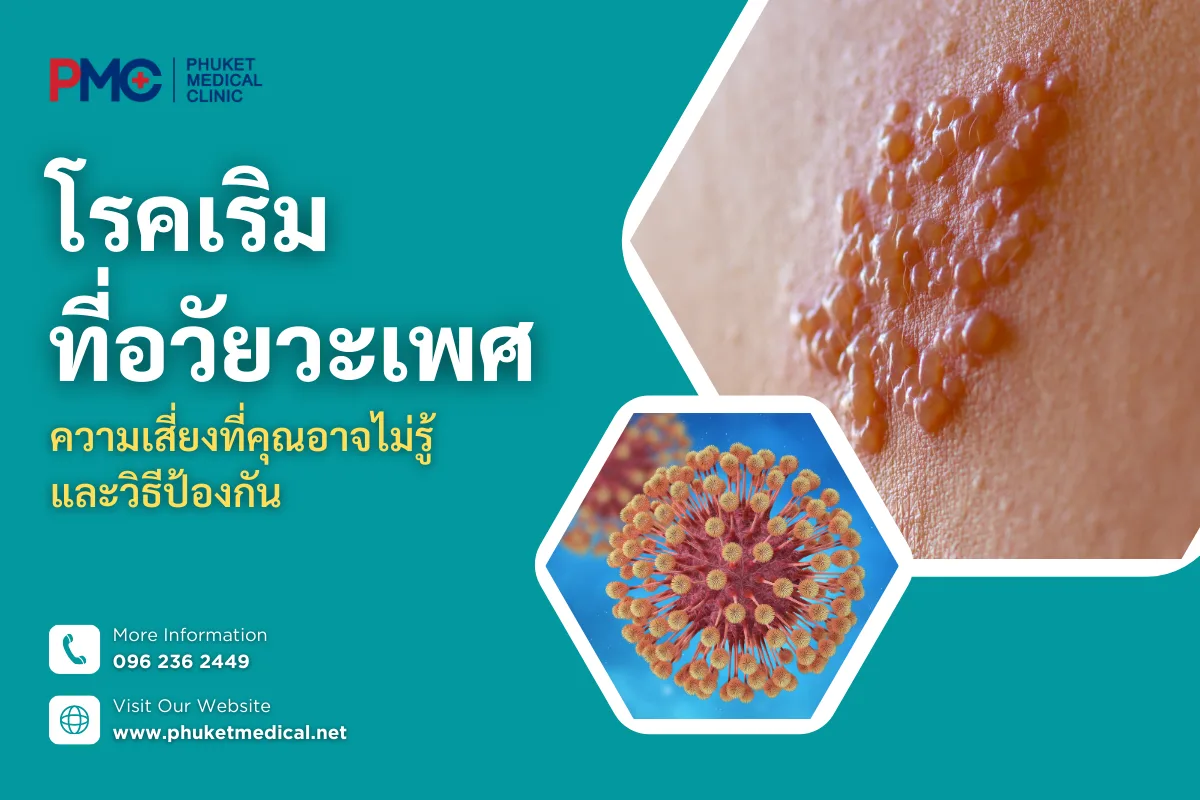 โรคเริมที่อวัยวะเพศความเสี่ยงที่คุณอาจไม่รู้ และวิธีป้องกัน