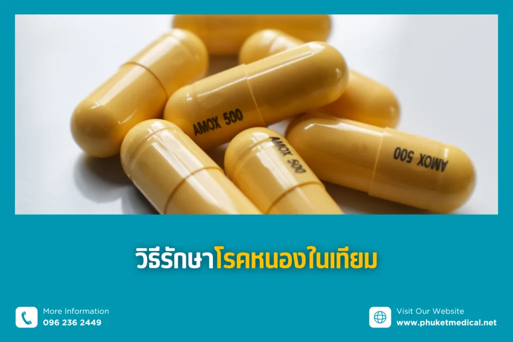 วิธีรักษา โรคหนองในเทียม
