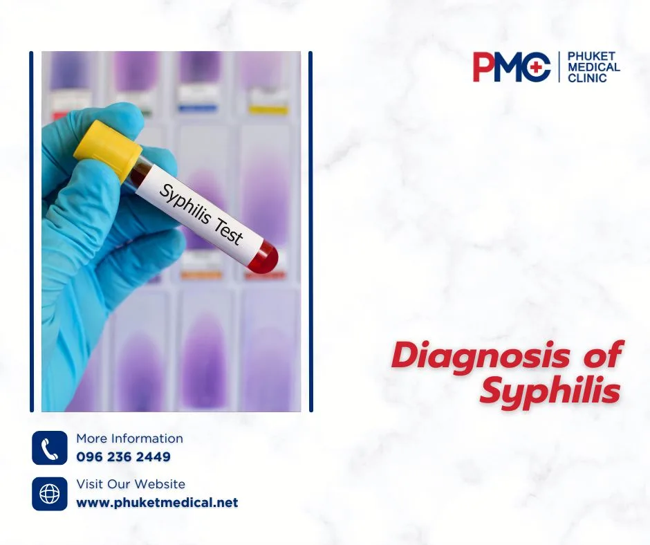 Diagnosis of Syphilis
