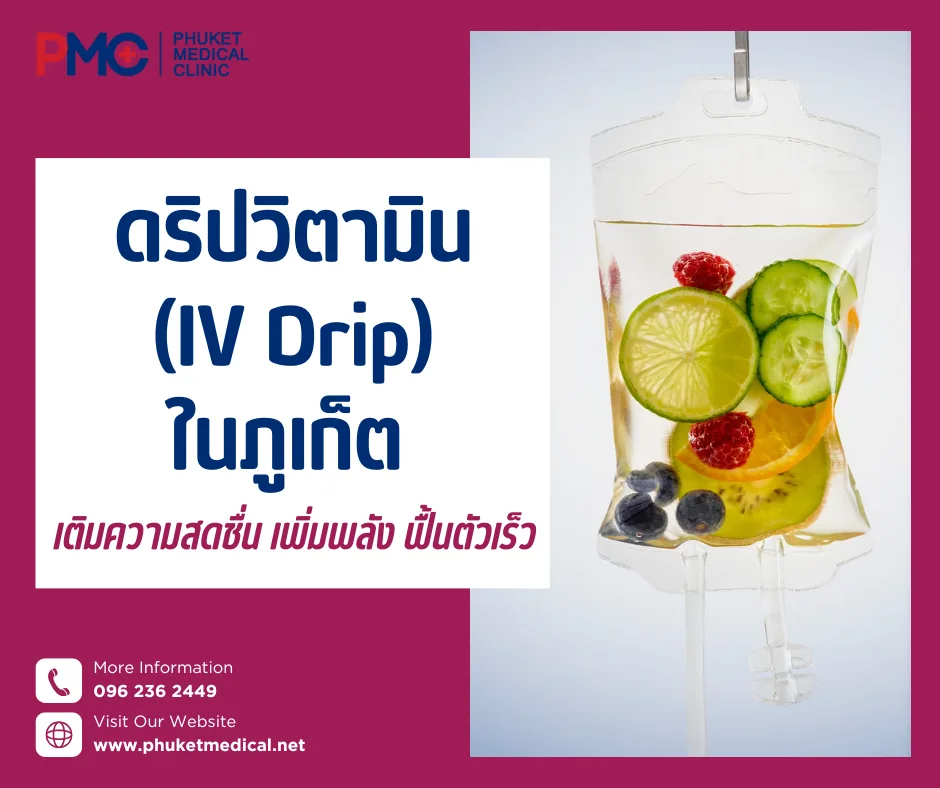 ดริปวิตามิน (IV Drip) ในภูเก็ต เติมความสดชื่น เพิ่มพลัง ฟื้นตัวเร็ว