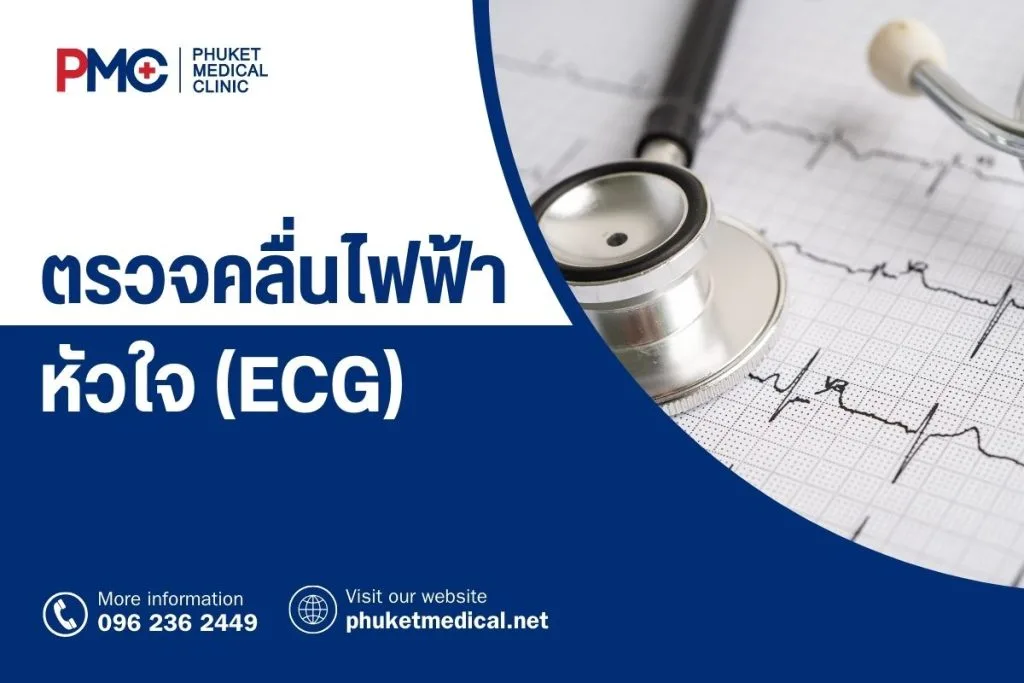 ตรวจคลื่นไฟฟ้าหัวใจ (ECG)